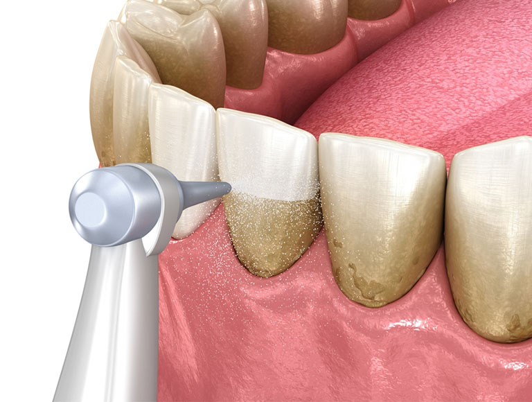What is Periodontics?
