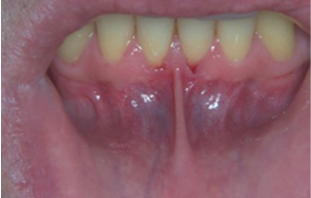 Patient Before After Image