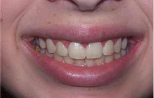 Patient Before After Image