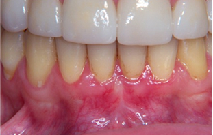 Patient Before After Image