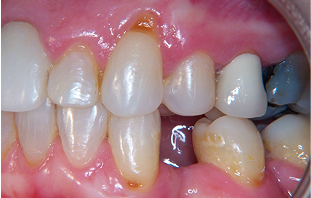 Patient Before After Image