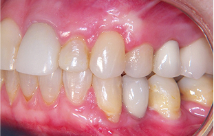Patient Before After Image
