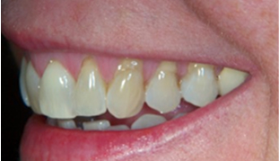 Patient Before After Image