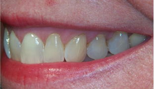 Patient Before After Image