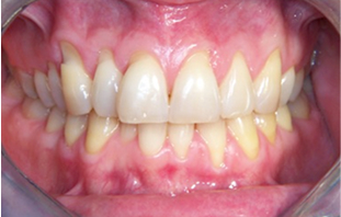 Patient Before After Image