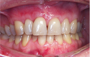 Patient Before After Image