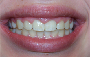 Patient Before After Image