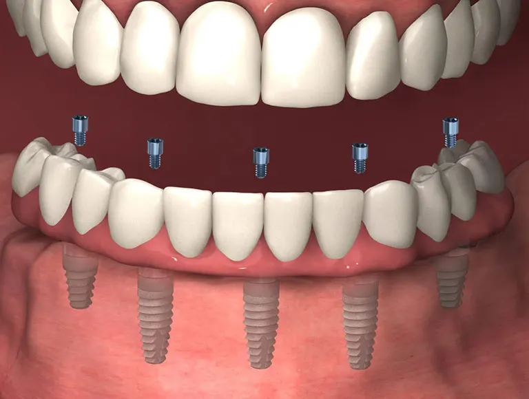 Is It Right for You?